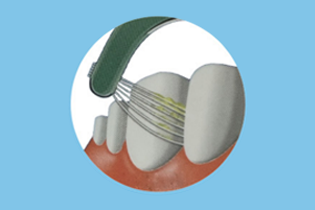 ブレテダンテクノロジー